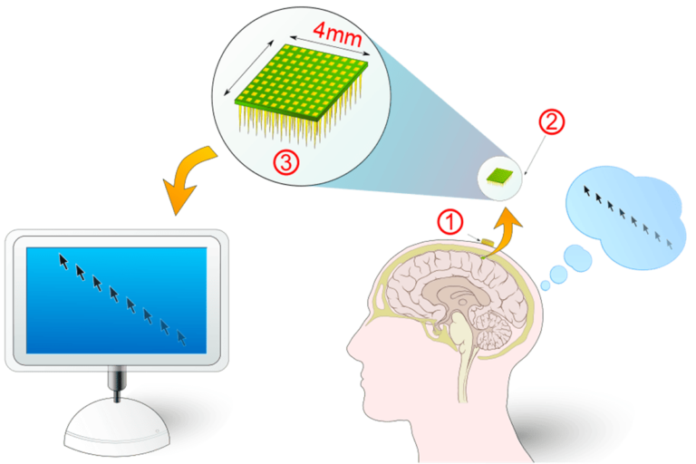 Brain Computer Interface (BCI)